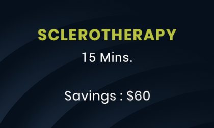 sclerotherapy
