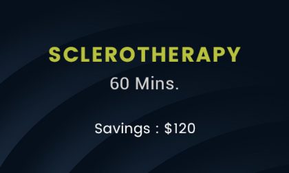 sclerotherapy 60 mins